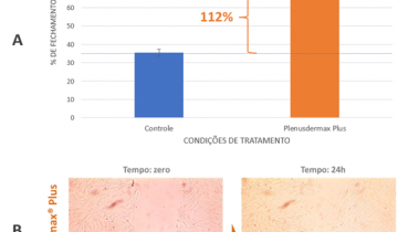 Autorregeneração da pele – Ingredientes que estimulam mecanismos de ação naturais do organismo.